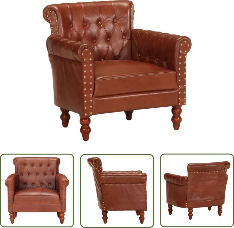 The Living Store Vintage Fauteuil Echt Geitenleer Bruin 77x63x76 cm Vintage Fauteuil Lederen Fauteuil Geiten Leer Fauteuil Retro Fauteuil Salontafel - Foto 2